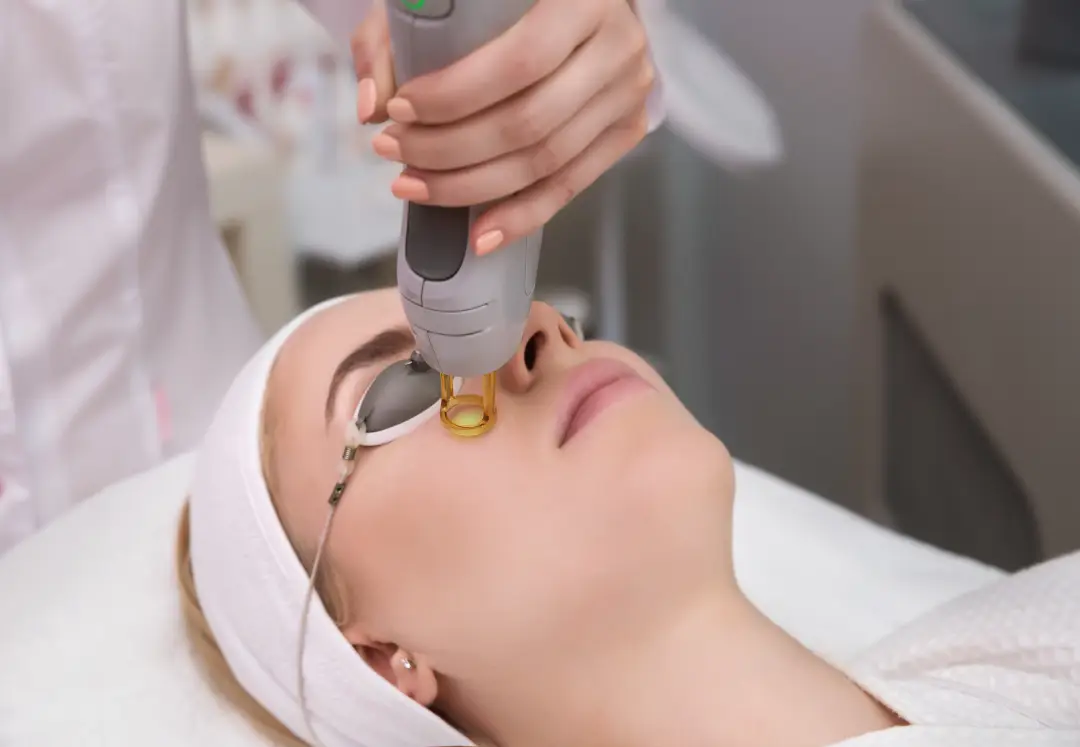 Top Benefits of Microneedling with SkinPen for Your Skin