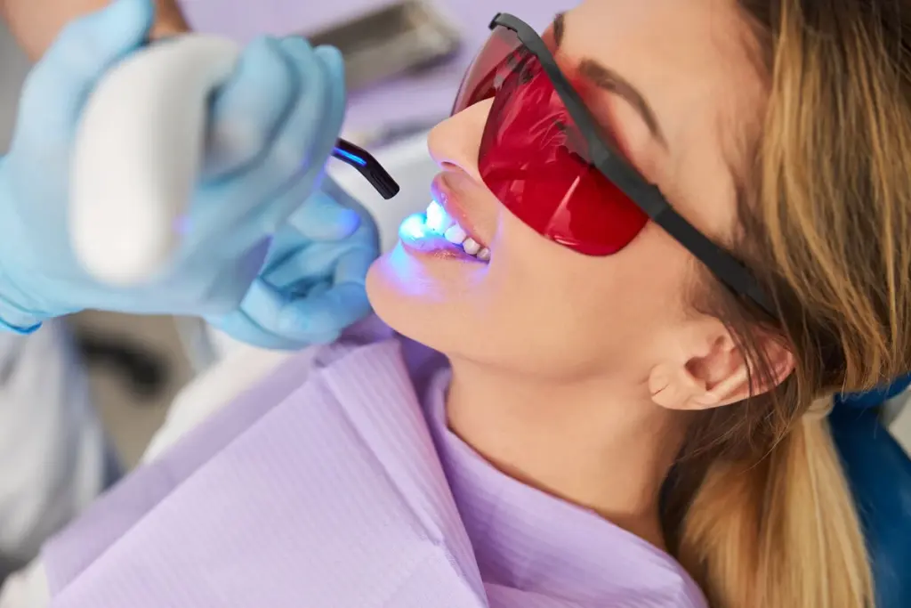 Dental Sealants
