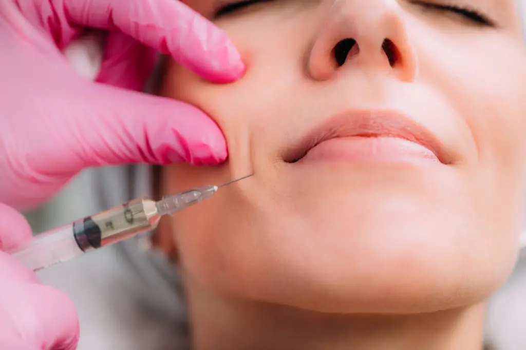 Dermal Fillers